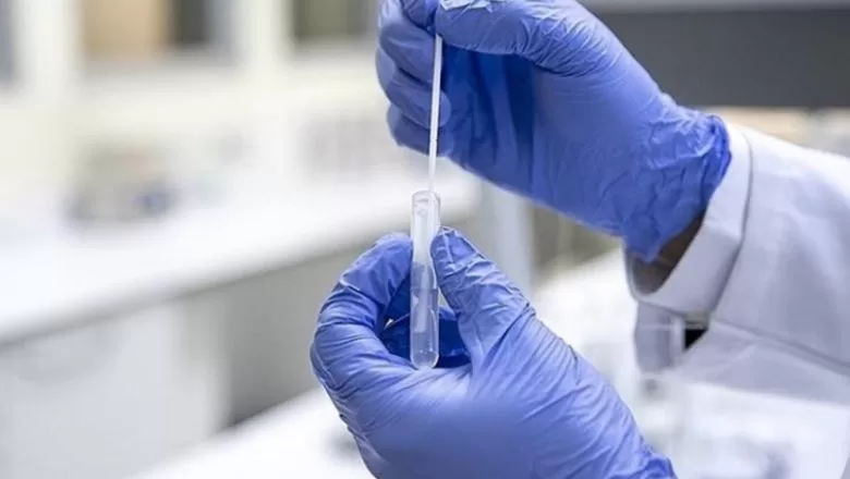 İngiltere'de, Kovid-19'un yeni varyantı Eris'in yayılma aşamasında olduğu ortaya çıktı.