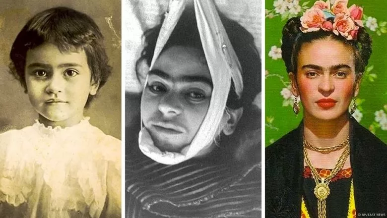 Sanatın Ruhu: Frida Kahlo